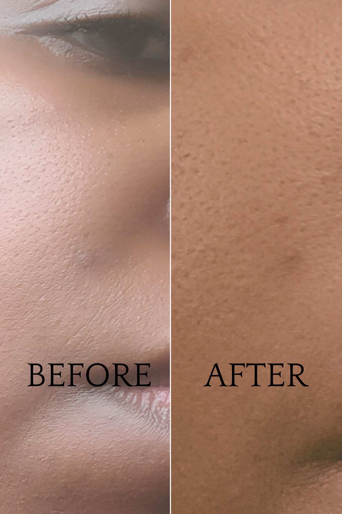 before after dark acne spot remover vitamin c serum daisy and mabel organics